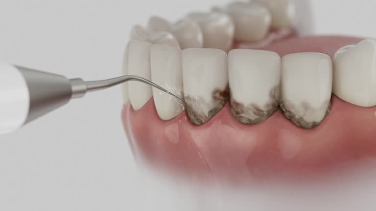 Reliable Dental Implants contractor in Clinton, NC by Smile Center Dentistry